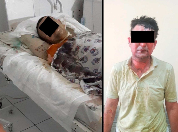 Самарқандда “опий” сақланган пропан газ баллони портлади