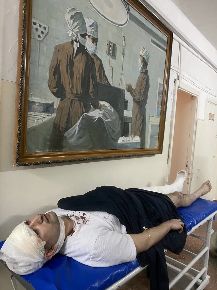 ЛГБТ ҳуқуқларини ҳимоя қилган блогер Миразиз Бозоров ўз уйи олдида дўппослаб кетилди