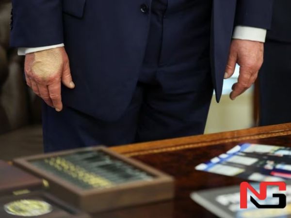 Трампнинг касали авж олгани айтилди