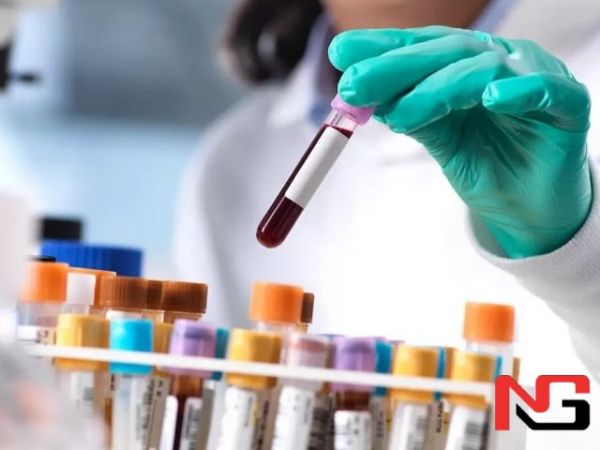 Япониялик олимлар барча қон гуруҳларига мос келадиган сунъий қон яратди