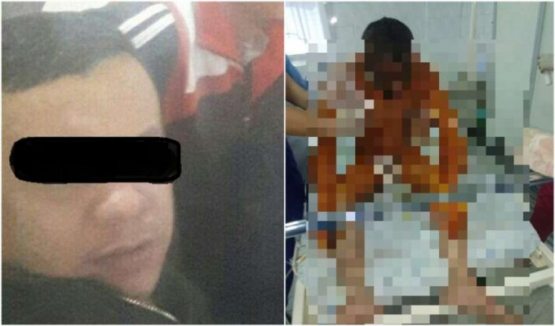 МИБ ходимлари олдида ўзини ёқиб юборган андижонлик фуқаро касалхонада вафот этди