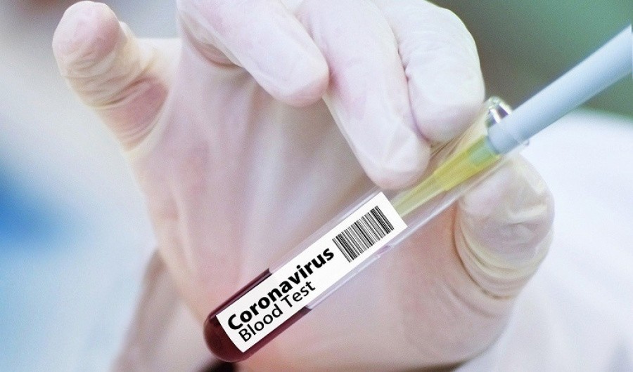 Тўрақўрғон туманида илк коронавирусга чалиниш ҳолати қайд этилди