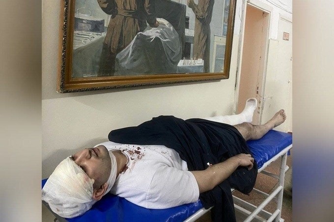 ЛГБТ фаоли Миразиз Бозоровга нисбатан жиноий иш қўзғатилди