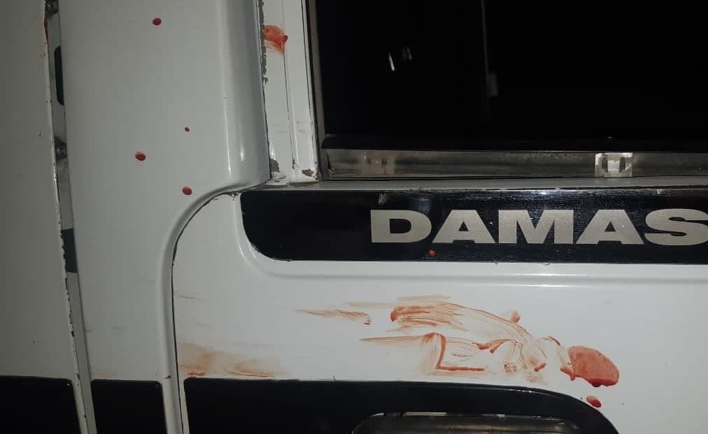 Синфдошнинг кўракда турмайдиган гаплари нима билан якунланди