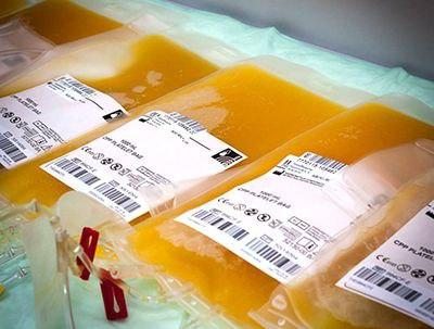 Хушхабар! Ўзбекистонда коронавирусни даволашда мутлақо янги усулдан фойдаланилади