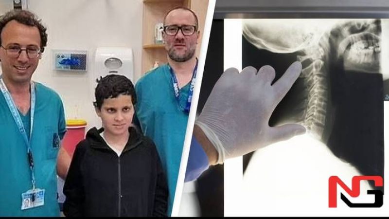 Исроилда шифокорлар боланинг узулиб кетган бошини қайта тиклади