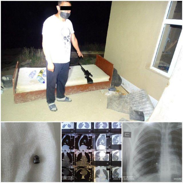 ўрдак овига чиққан фуқаро пневматик милтиқдан 20 яшар қизни отиб қўйди