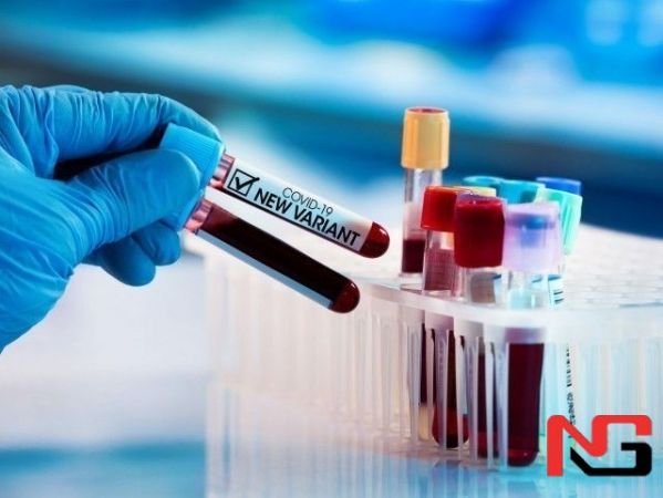 Диққат “омикрон”нинг янги мутацияси кенг тарқаляпти! Ўзбекистон ССВ огоҳлантирмоқда