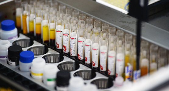 Ўзбекистон Туркиядан коронавирусни тез аниқлайдиган восита сотиб олди