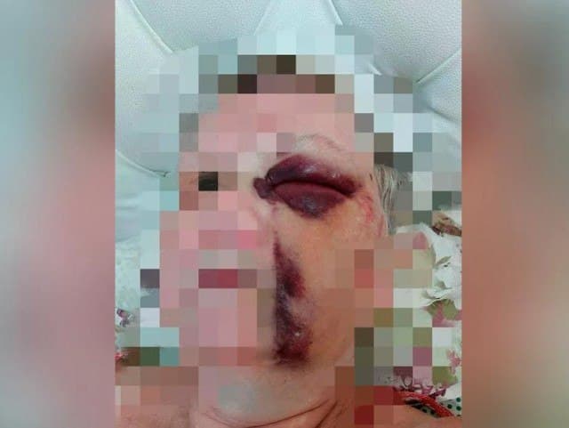 Тошкентда 63 ёшли аёлга тегажоқлик қилган йигитга жиноят иши қўзғатилди