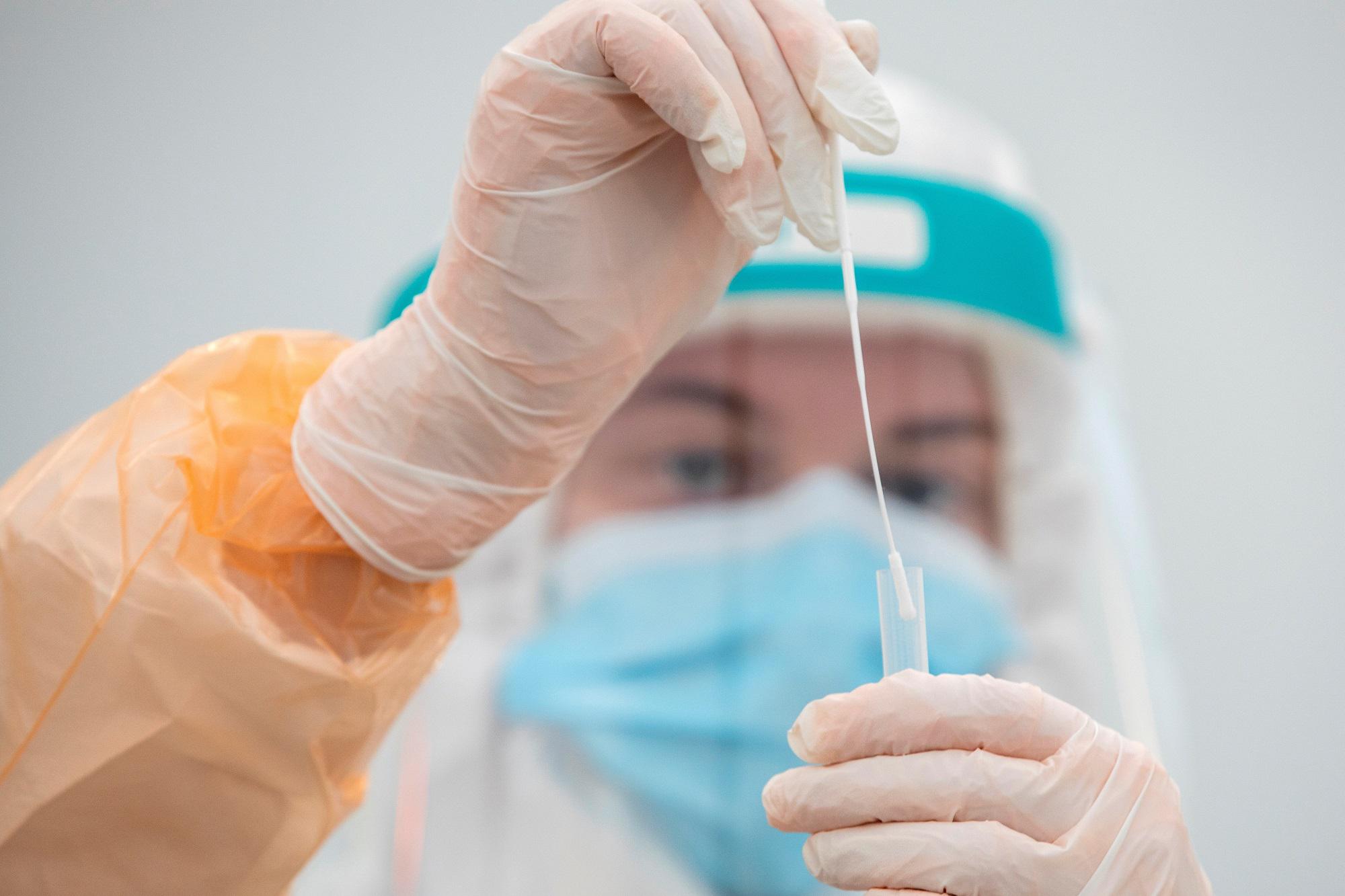 “Омикрон” штамми дунёнинг 77 мамлакатида аниқланди