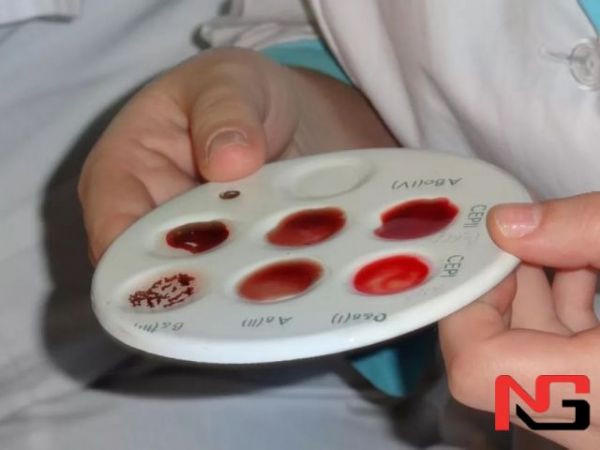 Ҳиндистонлик аёлда ҳеч кимда йўқ қон гуруҳи топилди