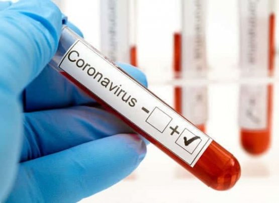 ДХХ “COVID-19” тестини сохталаштираётган гуруҳни фош этди