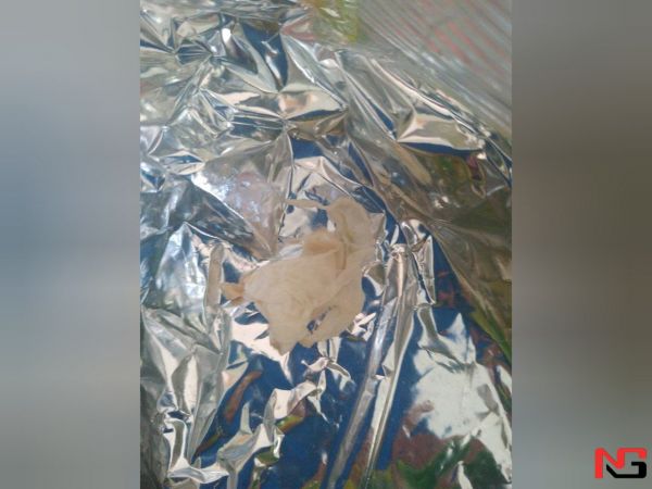 Наманганда яқинда она бўлган аёл қорнидан дастлаб тиббий дока, кейинчалик резина қўлқоплар чиқди