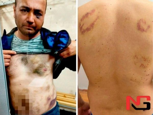 Омбудсман гумондорлар қийноққа солинаётганига муносабат билдирди