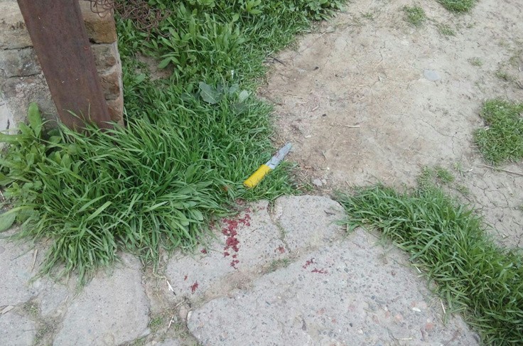 Тошкент вилоятида профилактика инспекторини пичоқлаган 18 ёшли йигит қўлга олинди