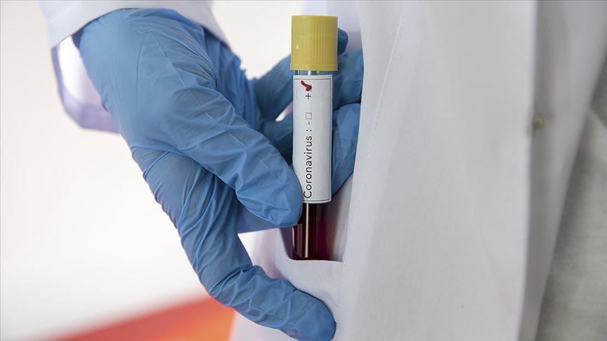 Коронавирус билан боғлиқ учта маълумот қуруқ сафсата эканлиги маълум бўлди