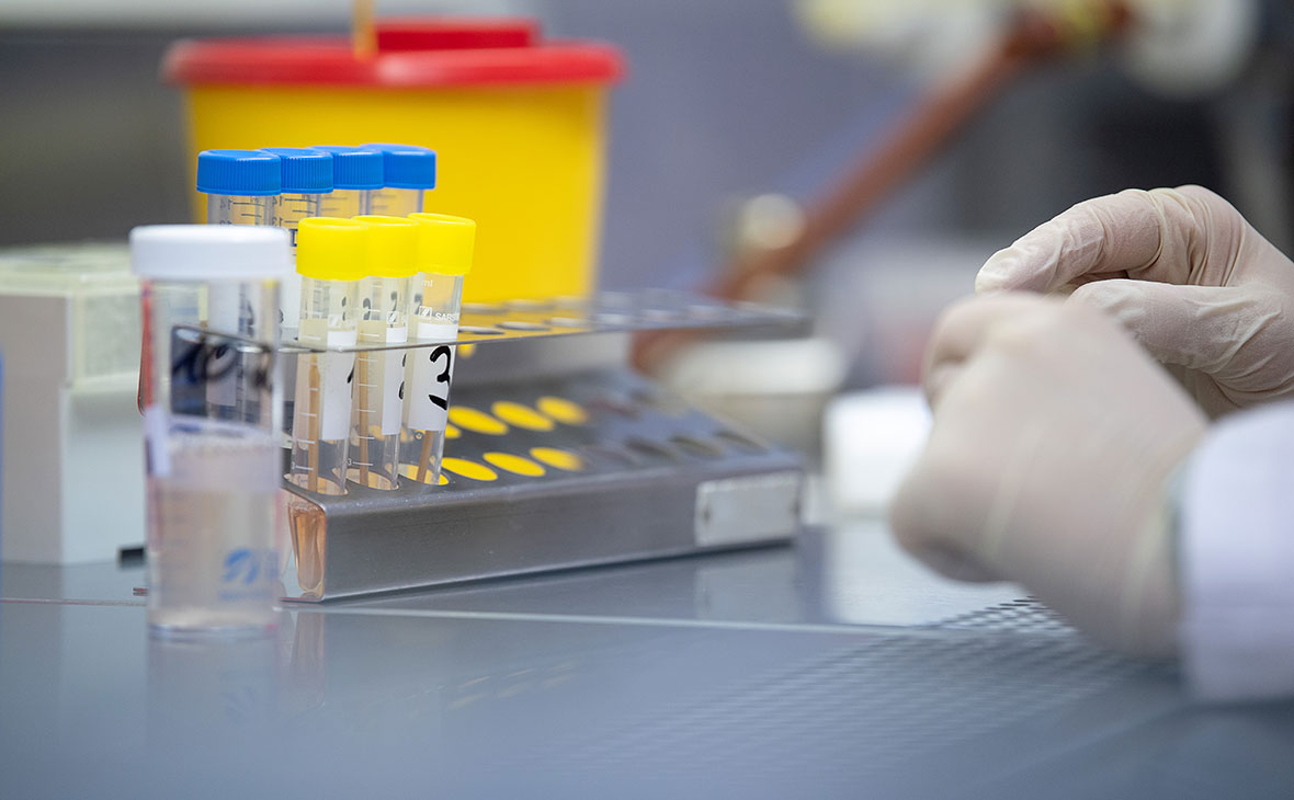 Келаси ҳафтадан Ўзбекистонда аҳолидан тест олиниши режалаштирилмоқда