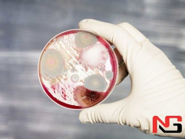 Қозоғистонда ўлган мол гўштини еганлар хавфли касалликка чалинди