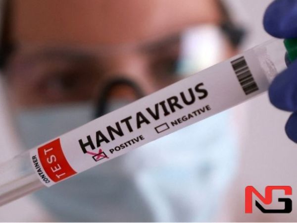 Исроилда ҳантавирус билан касалланишнинг илк ҳолати аниқланди