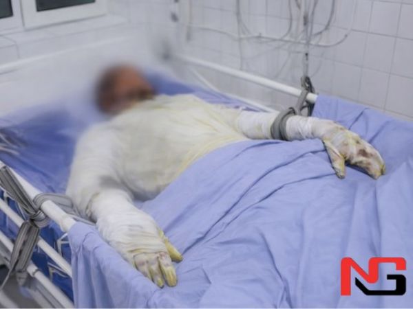 Чирчиқда вагон устида селфи тушмоқчи бўлган ўсмирни ток урди