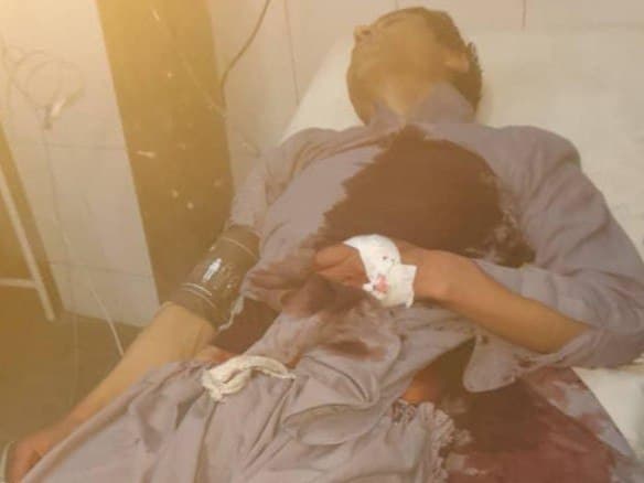 Журналист дўппосланди ва пичоқланди